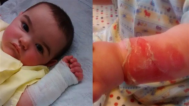 La mère du bébé ébouillanté en décembre dernier poursuivra la garderie