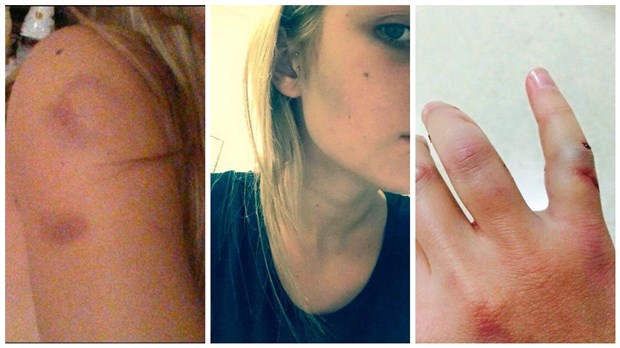 Violence conjugale : « Au début c'était des insultes... après je me faisais battre » — Sabrina Loubier