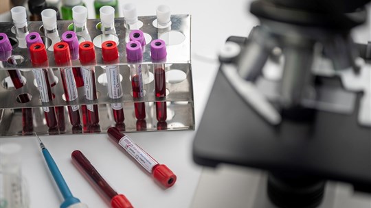 Santé Canada autorise un premier test de dépistage sérologique, annonce Ottawa