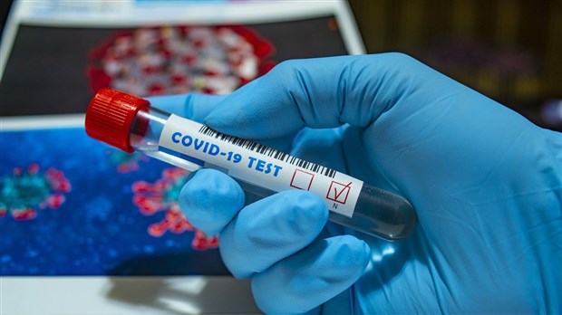COVID-19 : toujours plus de guérisons que de nouveaux cas
