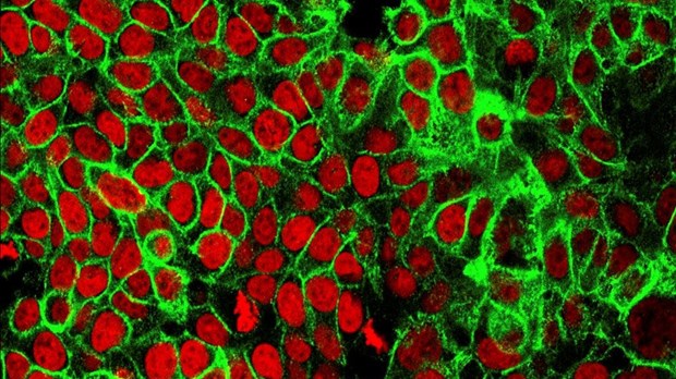 Cancer colorectal: une molécule contre la dépendance à la cocaïne offre un espoir