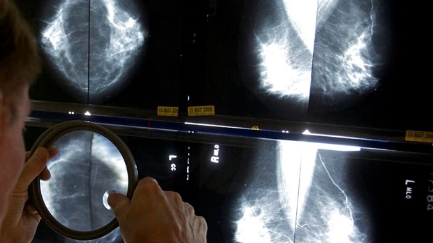 Cancer du sein: dépistage gratuit élargi aux Québécoises de 70 à 74 ans