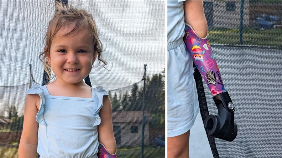Une Georgienne de 4 ans reçoit une prothèse pour faire du vélo